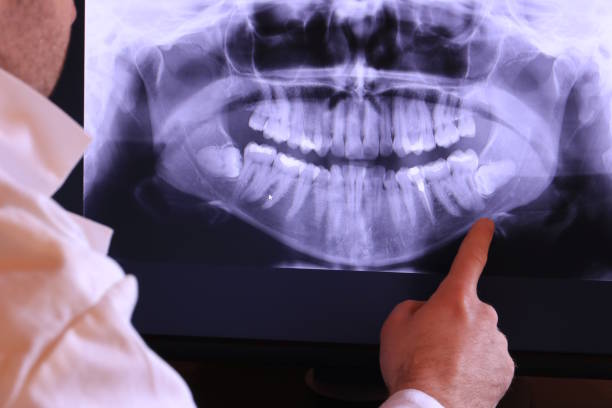Best Emergency Treatment for Toothache in North Newton, KS