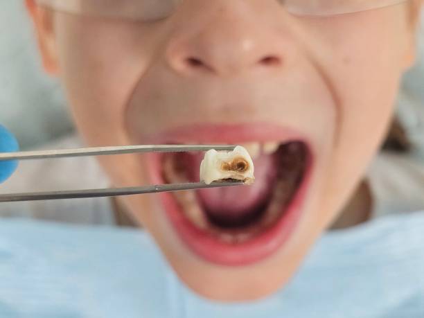 Best Emergency Treatment for Toothache in North Newton, KS